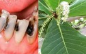 Lá bàng đun nóng: Hiệu quả từ đau răng, nhiệt miệng đến... viêm vùng kín  