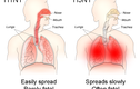 Cơ chế gây tử vong của cúm H5N1
