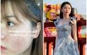 Lộ ảnh đầy mụn, tình cũ Quang Hải khiến netizen ngã ngửa