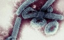 WHO xác nhận một loại virus chết người ở Ghana, có thể gây tử vong tới 90%