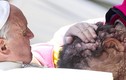 Cảm động giây phút Giáo hoàng ôm bệnh nhân bị u khắp mặt