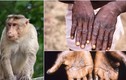 Video: Xem xét công bố tình trạng khẩn cấp toàn cầu về bệnh đậu mùa khỉ