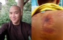 Sự thật phơi bày về thầy chùa bạo hành bé 11 tuổi ở Bình Thuận