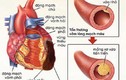 Rối loạn mỡ máu và nguy cơ các bệnh tim mạch