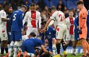 Sốc đội trưởng Chelsea bị đá vào đầu, bất tỉnh trên sân
