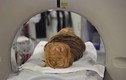 Ai Cập: Bị ung thư, 2.000 năm sau mới được phát hiện