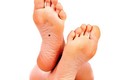 Nốt ruồi ở bàn chân mang ý nghĩa gì?