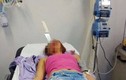 Video: Cô gái bị cắm thẳng dao găm vào mặt khi chống trả tên cướp
