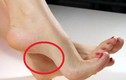 5 dấu hiệu có của ở bàn chân, hậu vận thành tỷ phú