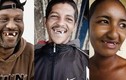 Video: Nhổ một loạt răng cửa để trở thành 'bậc thầy' khi hôn