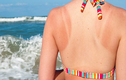 Những cách chăm sóc da bị cháy nắng giúp da lên tông nhanh 