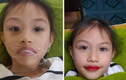 Xôn xao phụ huynh để con gái 5 tuổi xăm môi đỏ