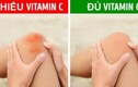 Những dấu hiệu cảnh báo bạn thiếu vitamin C trầm trọng