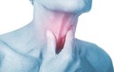 Yếu tố nào gây nên bệnh ung thư vòm họng?