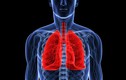 5 dấu hiệu cảnh báo ung thư phổi khi hút thuốc, chớ chủ quan