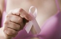 6 dấu hiệu cảnh báo sớm ung thư vú bạn không nên bỏ qua 