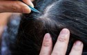 Mối nguy hại khôn lường từ việc nhổ tóc bạc
