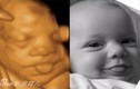 Khoảnh khắc giống nhau kỳ lạ của bé trước và sau sinh