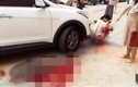 Bé gái 2 tuổi chơi trước đầu xe ô tô bị cán tử vong