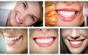 Bí quyết để hàm răng trắng bóng không cần đến nha sĩ