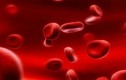 8 loại bệnh về máu bạn không thể bỏ qua