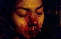 CSGT Hàng Xanh bị tố “hành hung” phụ nữ dập mũi... nhập viện