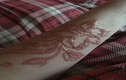Cô gái trẻ bị bỏng hóa học, mang sẹo cả đời vì xăm hình Henna