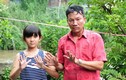 Kỳ lạ, cả gia đình ở An Giang có 24 ngón tay, chân 