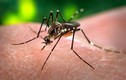 Virus Zika có thể gây tổn thương não người lớn nghiêm trọng