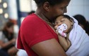 Báo động virus Zika ăn não lây lan đến 30 quốc gia