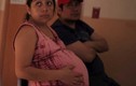 Phát hiện phụ nữ mang thai đầu tiên nhiễm virus Zika