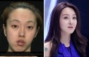 Công cuộc "lột xác ngoạn mục" của gái xấu xứ Hàn