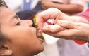 Khẩn cấp ngừng sử dụng, tiêu hủy vacxin bại liệt tOPV