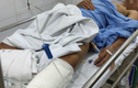 Nguyên nhân mổ nhầm chân ở Bệnh viện Việt Đức là gì?