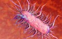 Vi khuẩn “ăn thịt người” nguy hiểm hơn với người mắc bệnh mãn tính