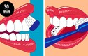 8 lỗi chăm sóc răng miệng đang hủy hoại răng bạn từng ngày
