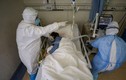 Hai nữ điều dưỡng của Bệnh viện Bạch Mai là ca nhiễm Covid-19 thứ 86, 87