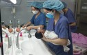 Phụ nữ mang thai nhiễm Covid-19 phải thở máy, Bộ Y tế hướng dẫn xử trí thế nào?