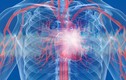 Ngoài phổi, bộ phận cơ thể nào cũng tổn thương nghiêm trọng khi nhiễm COVID-19?