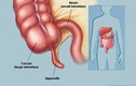 8 bộ phận vô dụng đến “thừa thãi” trên cơ thể chúng ta