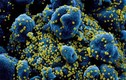 BN COVID-19 ở HN bị “bão cytokine” nguy hiểm thế nào?