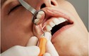 Nha sĩ cố tình làm gãy răng của bệnh nhân để kiếm tiền điều trị