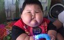 Bé trai 1 tuổi béo phì nặng 27kg, to bằng bé 8 tuổi