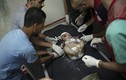 Nguồn điện của bệnh viện Dải Gaza cạn kiệt, trẻ sơ sinh lâm nguy