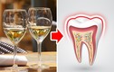 Các loại thực phẩm phổ biến gây hại men răng