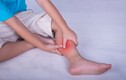 5 triệu chứng xuất hiện ở tay chân, khám huyết khối ngay còn kịp