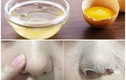 Mối nguy hiểm khi dùng mặt nạ lòng trắng trứng