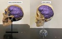 Vì sao người Neanderthal huyền thoại đột ngột biến mất khỏi Trái đất? 