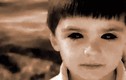 Bí ẩn những đứa trẻ có đôi mắt của “thần chết“