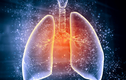 Tìm thấy thứ hoàn toàn mới trong phổi người, có thể "thiên biến vạn hoá" 